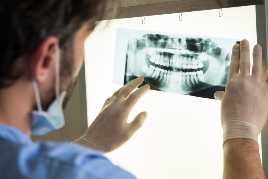 Dentist examining the x-ray