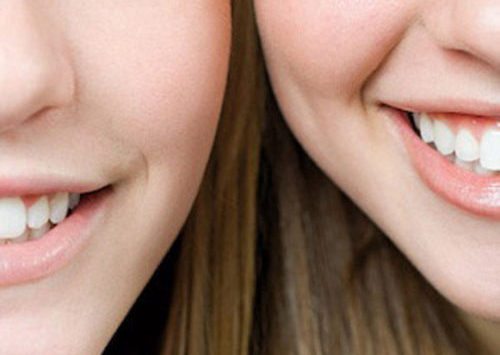 Closeup image of two smiling women focused on their teeth