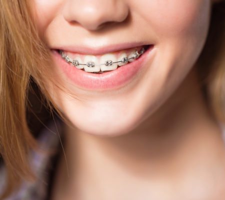 Portrait of teen girl showing braces