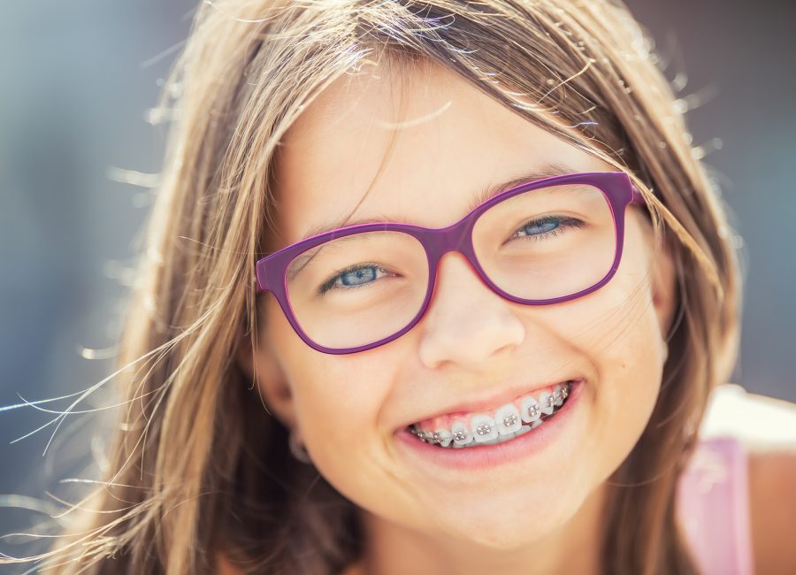 Little girl with glasses smiling and showing her self ligating braces