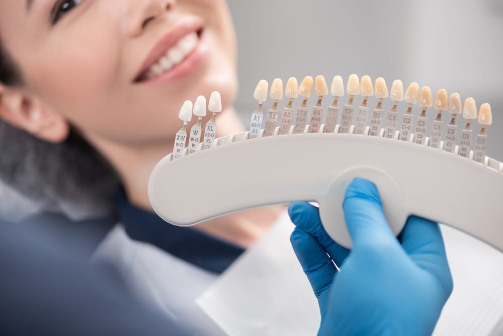 remove-gaps-in-your-teeth-with-veneers-titirangi-dental