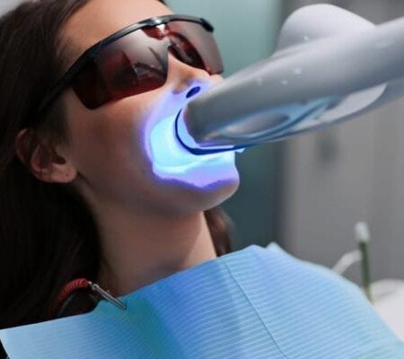 Female patient at dentist in the clinic. Teeth whitening procedure with ultraviolet light UV lamp.
